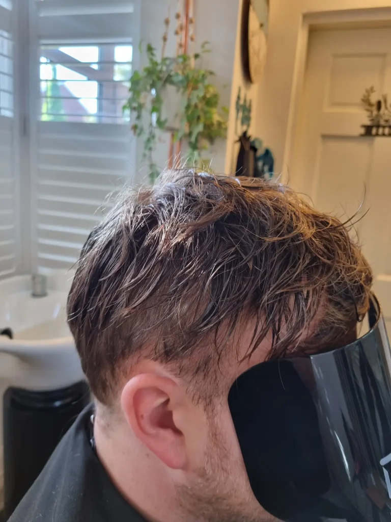Clarity Hair Solutions client with a new bespoke hair system.